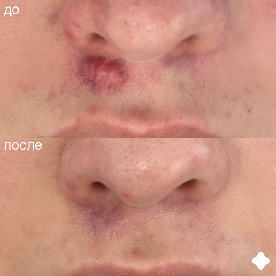 Фотолардағы пирсингімен блят Фотолардағы пирсингімен блят