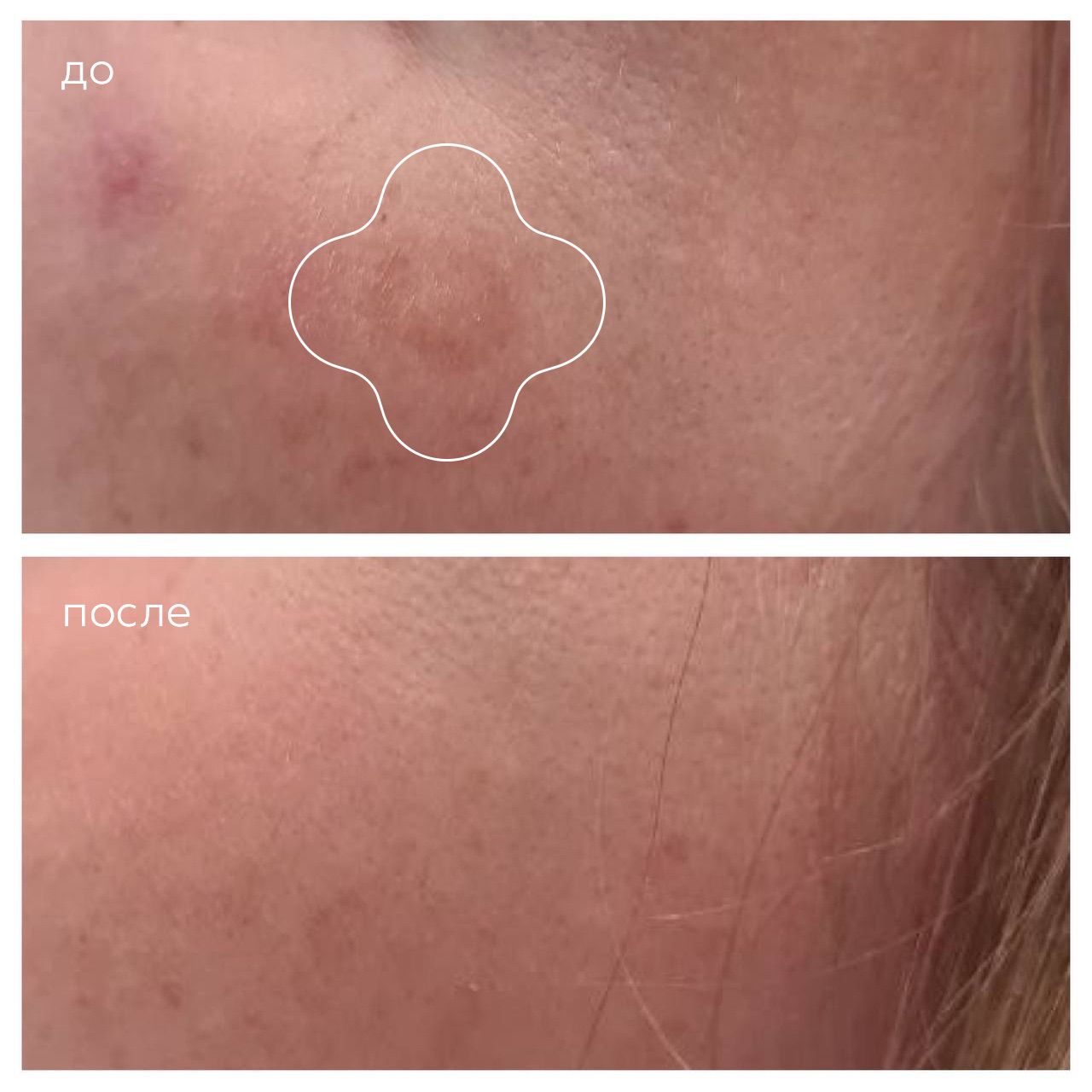 Емельяненко Александра Олеговна — Клиника медицины кожи