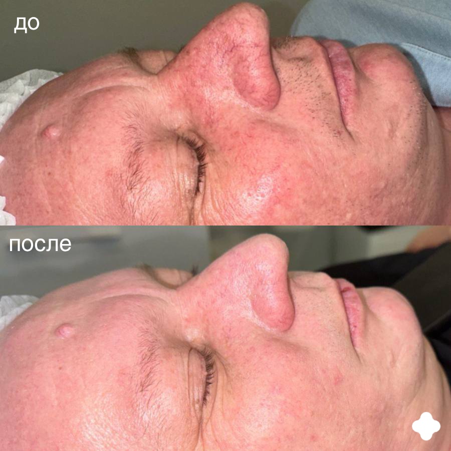 Мерлин телехикаясындағы жалаңаш Гвеннің суреті Трусики жоқ стюардессалар