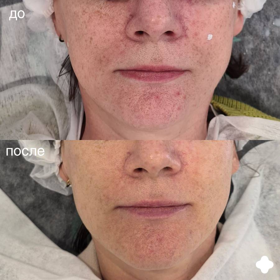 Лесби душ порно видео онлайн 720p АҚШ порно актрисалары